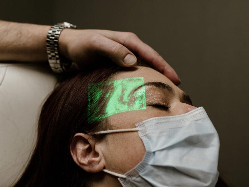 hair transplane procedure