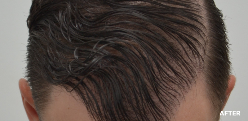 before image