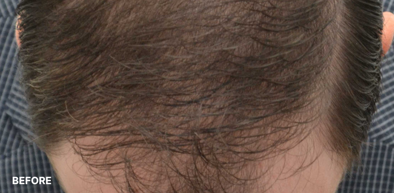 after image