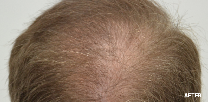 before image