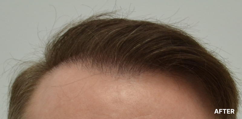 before image