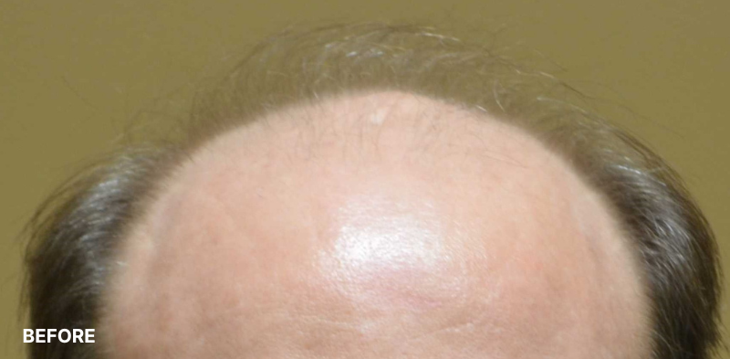 after image