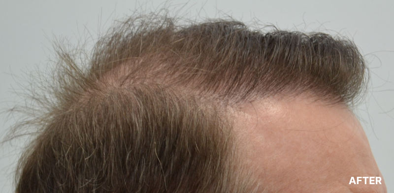 before image