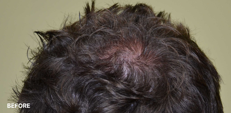 after image