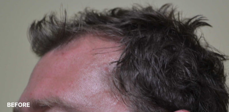after image