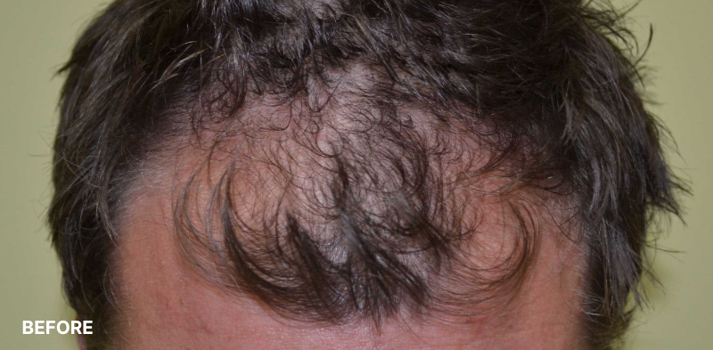 after image