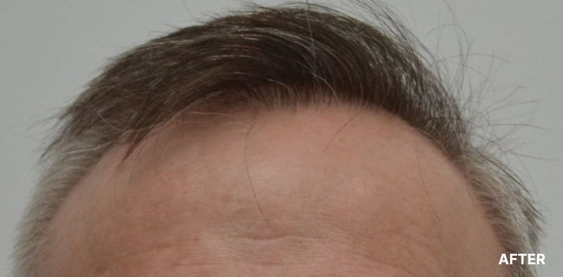 before image