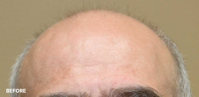 after image