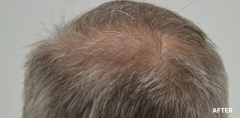 before image