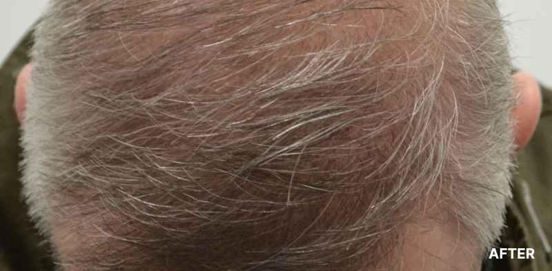 before image