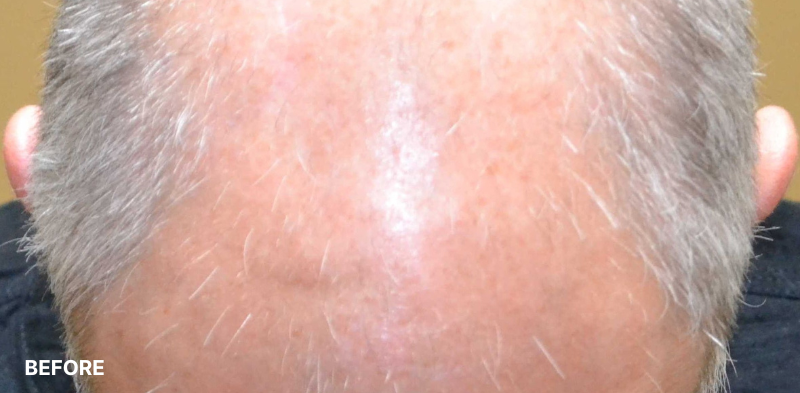 after image