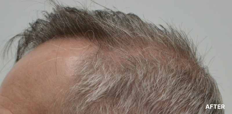 before image