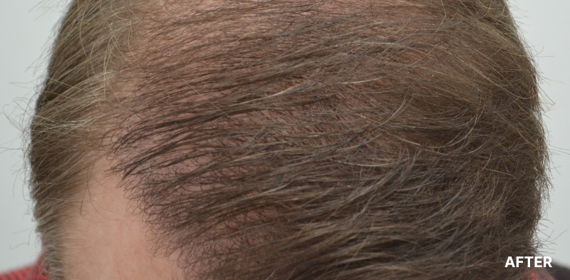 before image