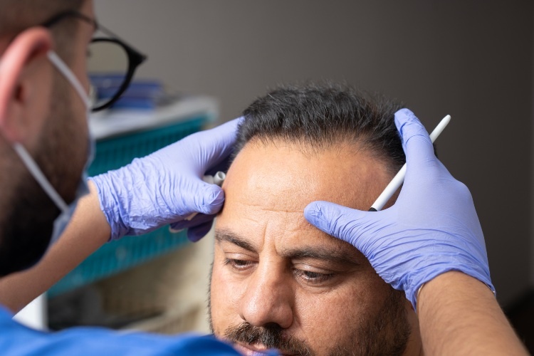 Identifying nutrient deficiencies causing men's hair loss, treated in the Greater Edmonton Area
