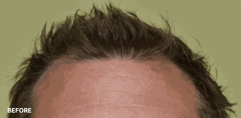 after image