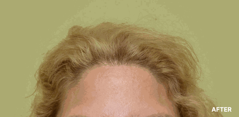 before image
