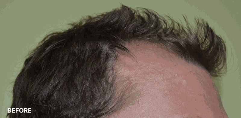 after image