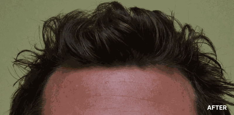 before image