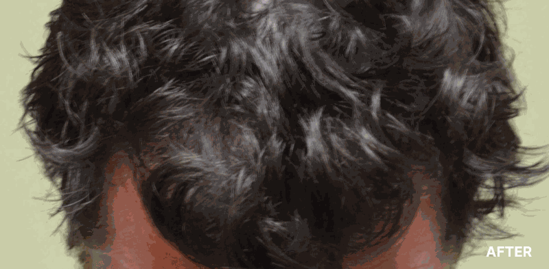 before image