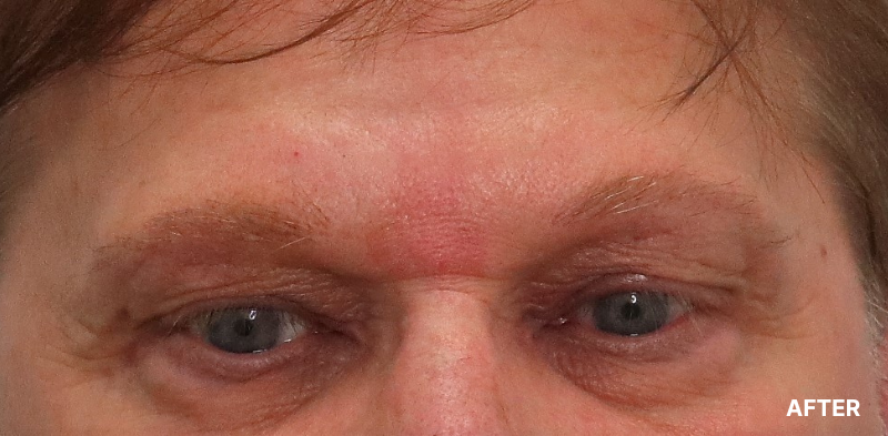 before image