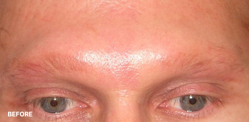 after image