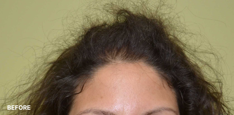 after image