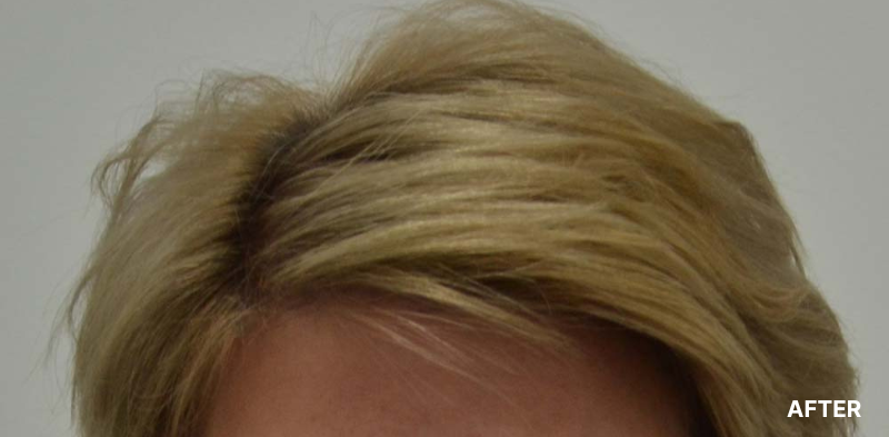before image