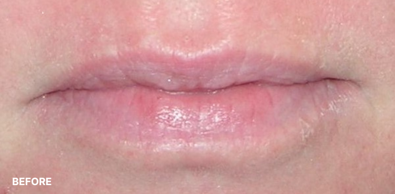after image
