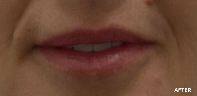 before image