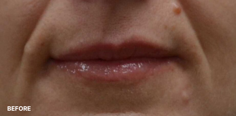 after image