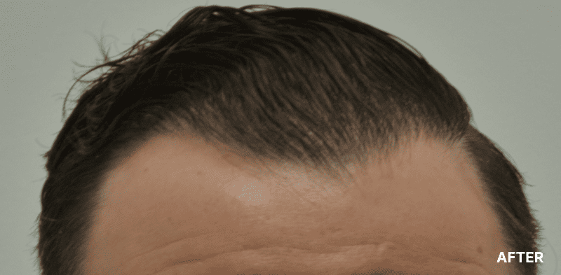 before image