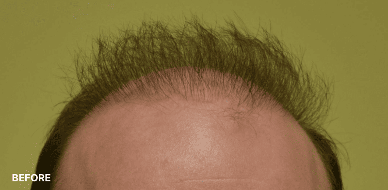 after image